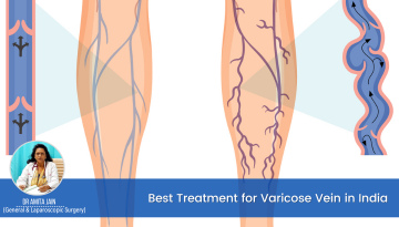 varicose vein doctor and surgeon Dr Amita Jain